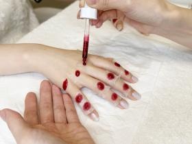 施術写真ピーリング